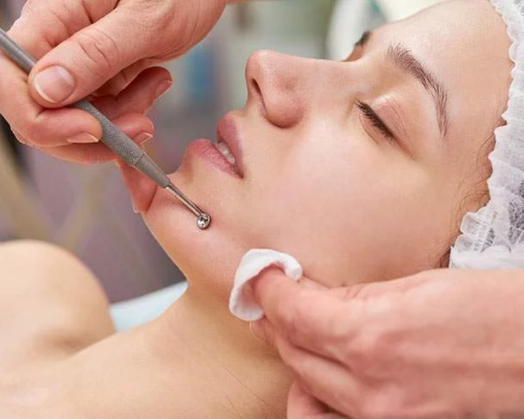 Extracción de puntos 