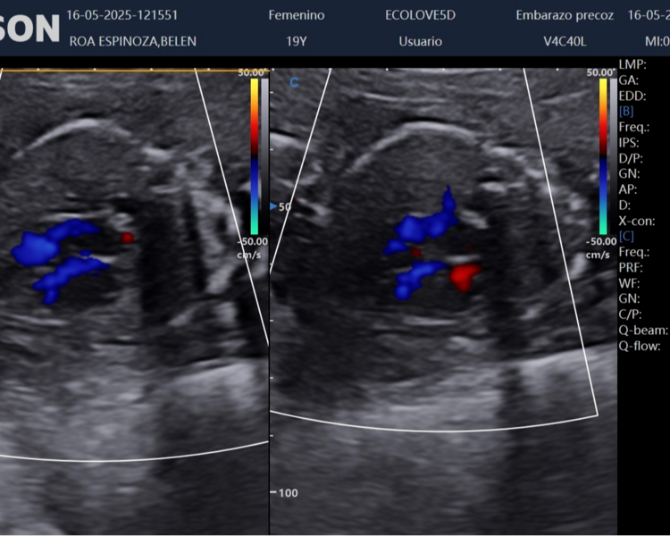 Ecografías Doppler 1er y 2do trimestre + 5D  