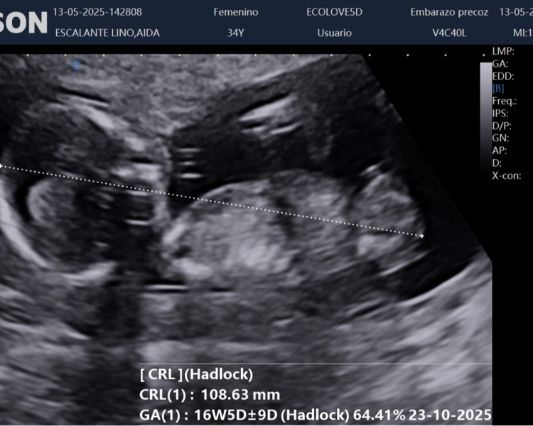 Ecografías Doppler 1er y 2do trimestre + 5D  