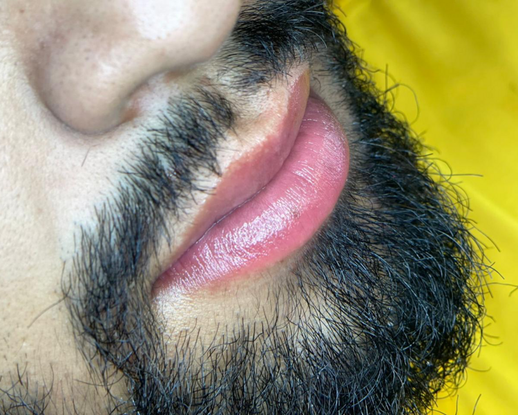 Hidratación de Labios