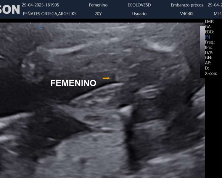 Revelación de sexo + 5D