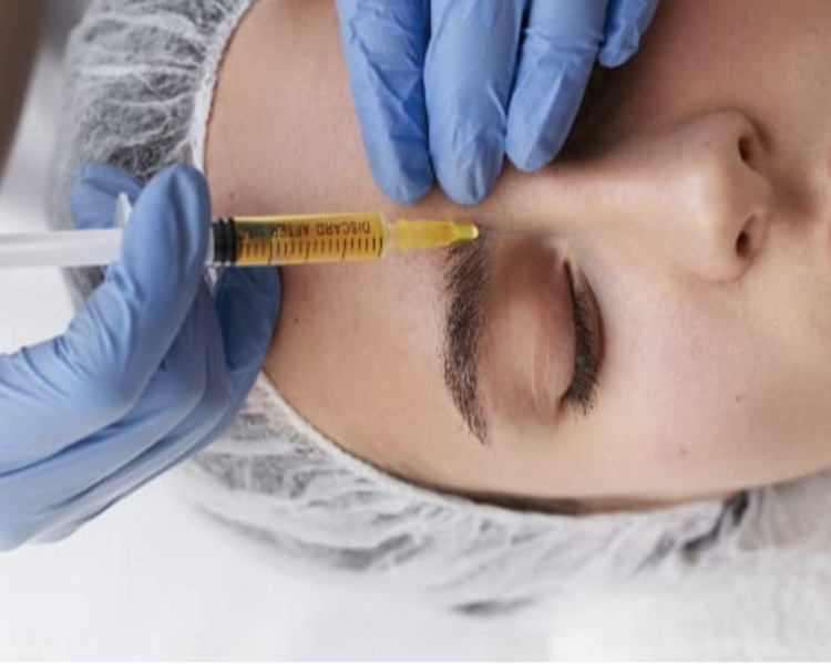 Plasma rico en plaquetas facial