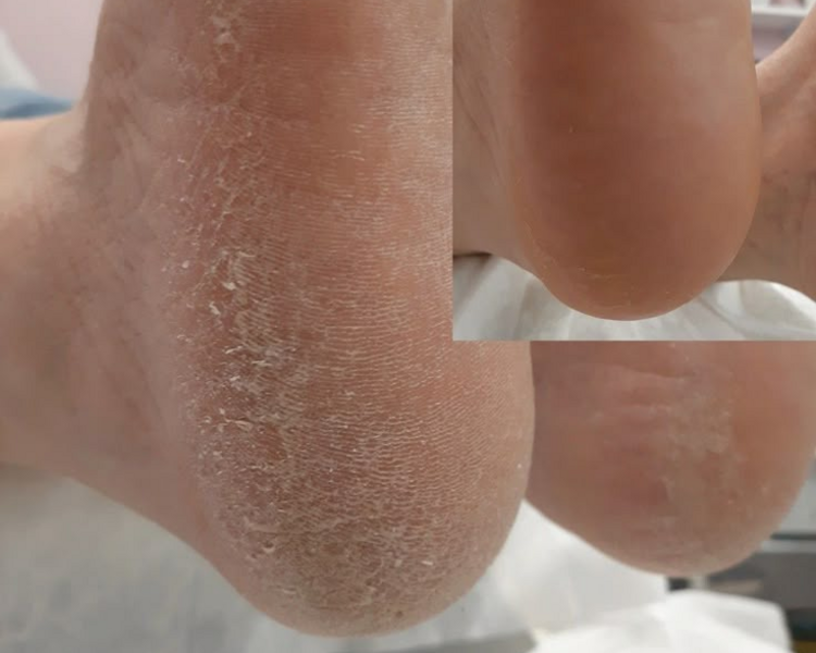 Pedicuria Sin Esmaltar