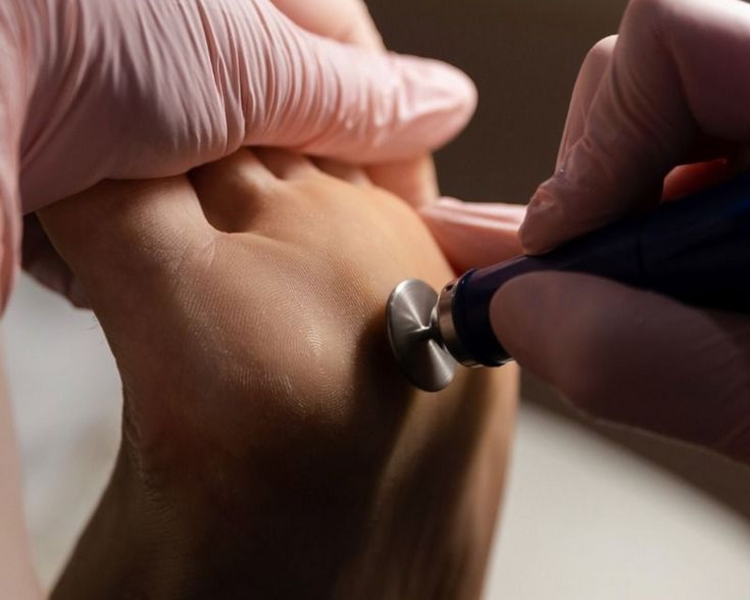 Pedicuria Sin Esmaltar