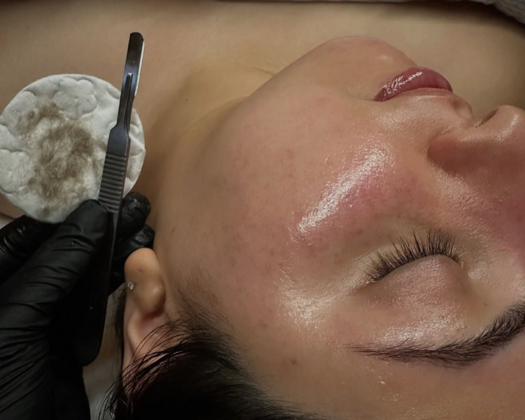 K-Beauty Glow con Dermaplaning