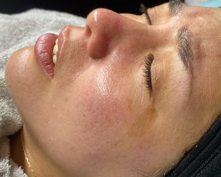 Dermaplaning Glow Facial