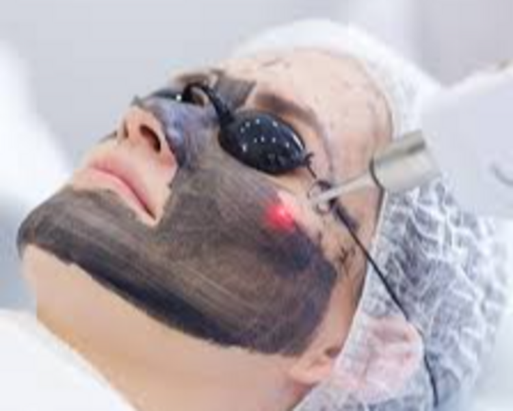 Hollywood Peel