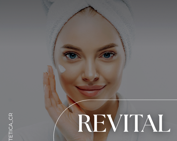 Revolution Peel