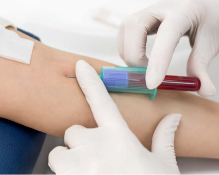 Toma de muestras (Exámenes de laboratorio)