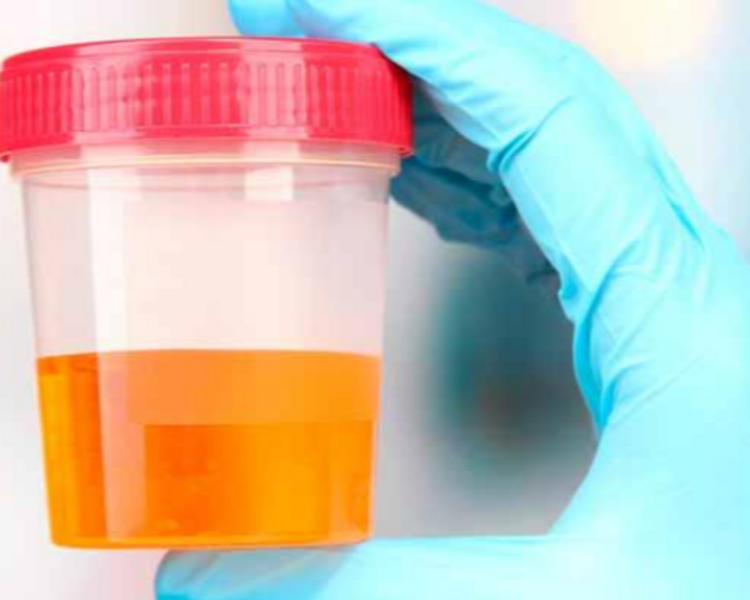 Toma de muestras (Exámenes de laboratorio)