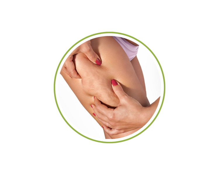 4 Sesiones ( Corporal Piel de Naranja) + R.F. + Presoterapia + Bote de colágeno