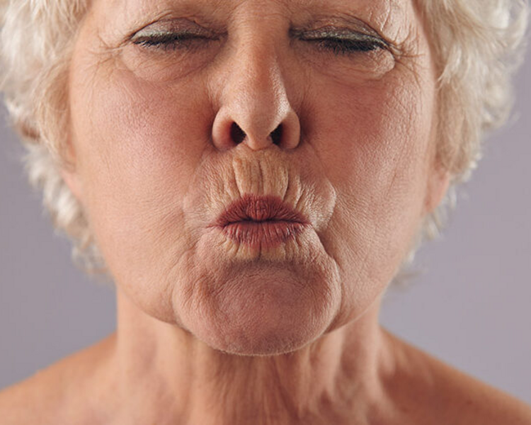 Arrugas de código de barras- Miomodulación