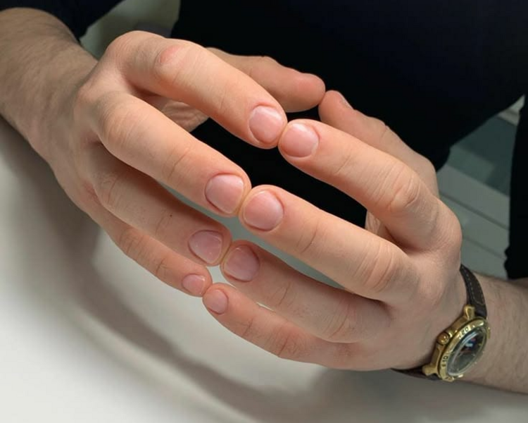 LIMPIEZA DE UÑAS/MANOS