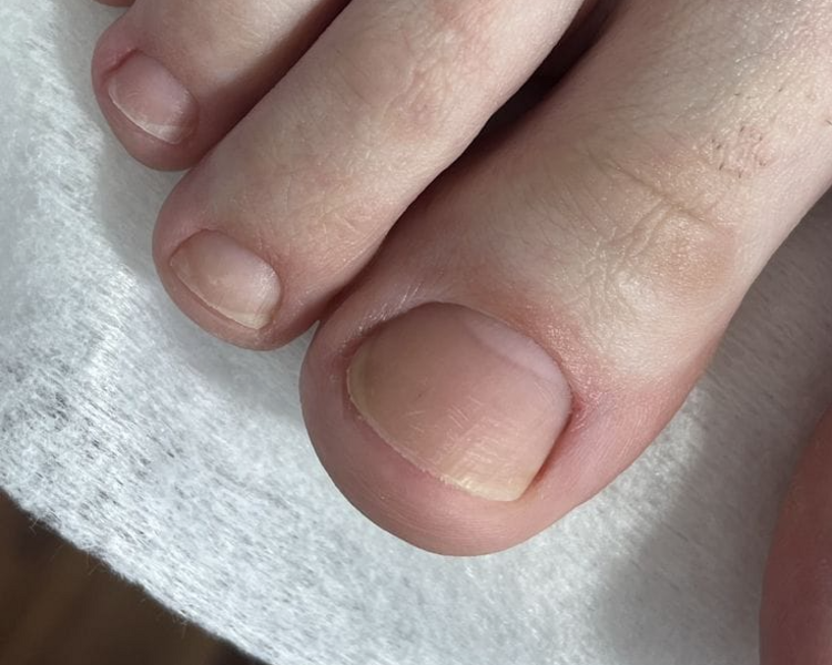 LIMPIEZA DE UÑAS
