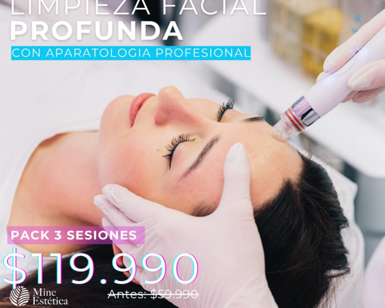CYBER LIMPIEZA FACIAL PROFUNDA 3 SESIONES 