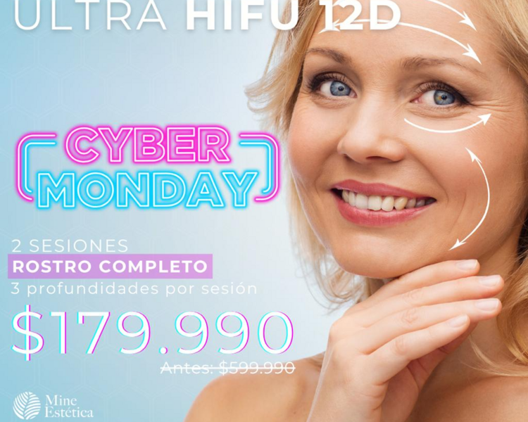 CYBER 2 SESIONES ULTRA HIFU 12D ROSTRO COMPLETO 