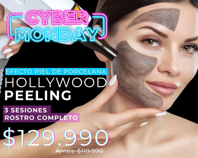 CYBER HOLLYWOOD PEELING 3 SESIONES 