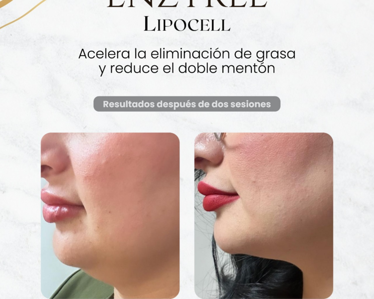 ENZIMAS LIPOCELL