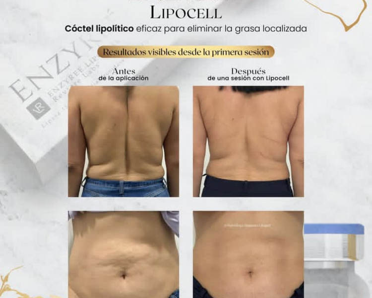 ENZIMAS LIPOCELL
