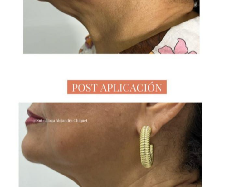 ENZIMAS LIPOCELL