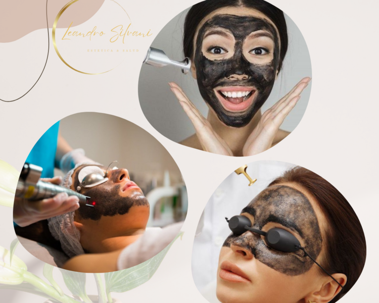 Hollywood Laser Peel