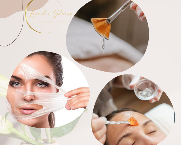Peeling Quimico
