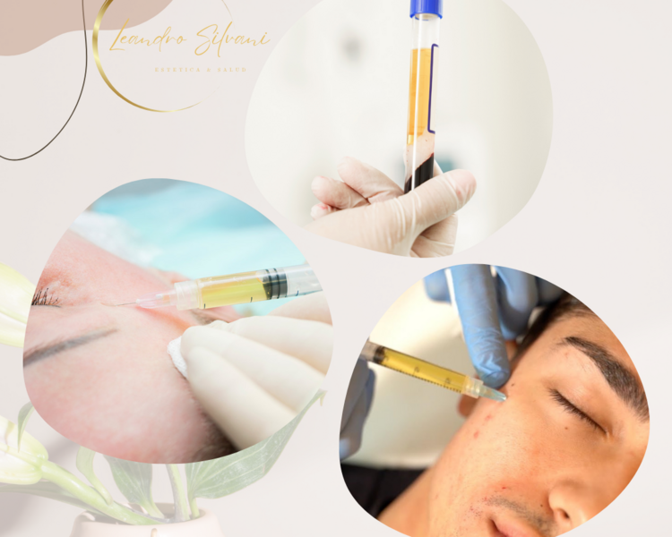 PRP Facial