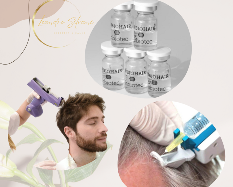 Mesoterapia Capilar con InbioHair