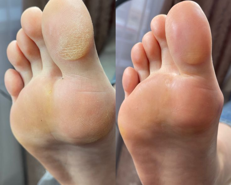 Spa de pies Hombre