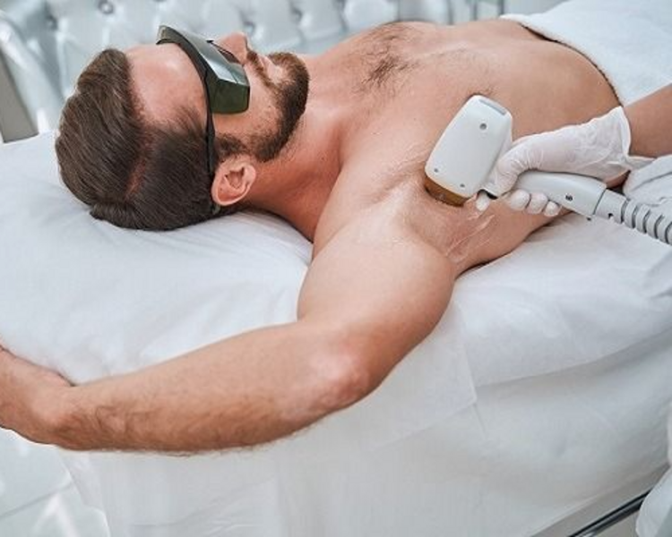 Depilacion Laser