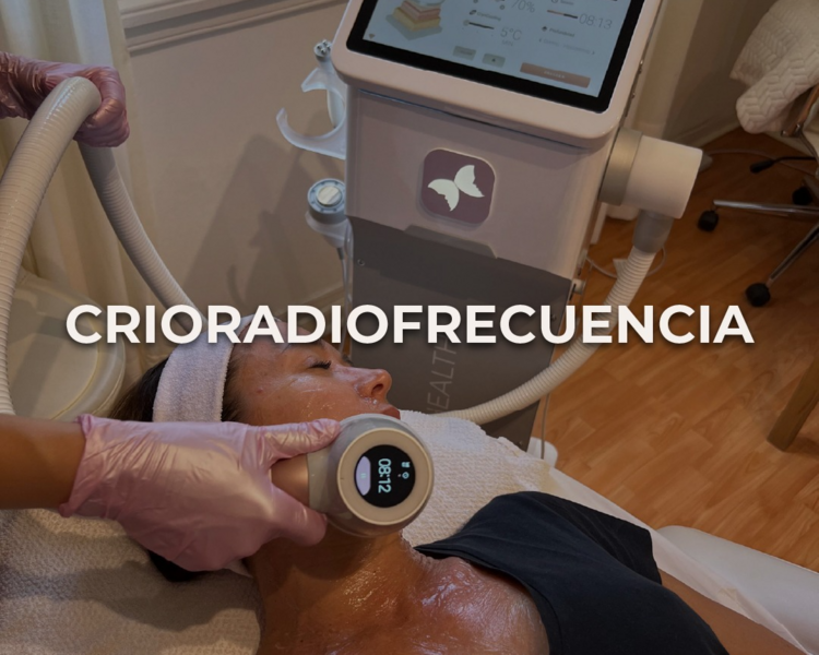 CRIORADIOFRECUENCIA FACIAL
