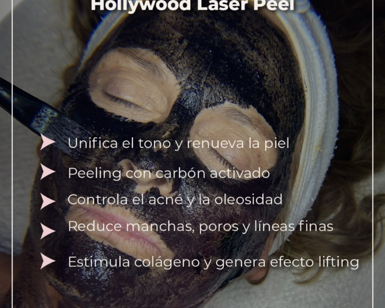 Hollywood laser peel