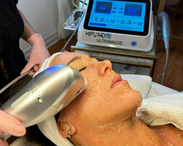 HIFU 14 D FACIAL