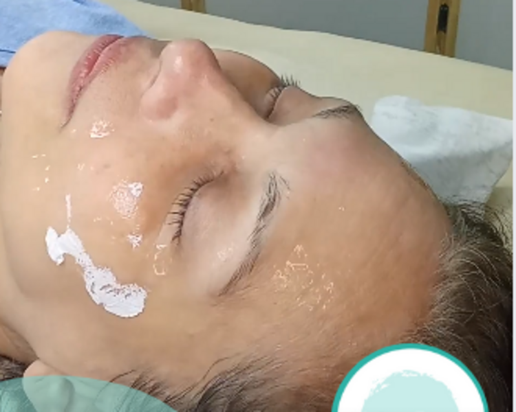 Tratamiento antiage con Parches de colágeno 