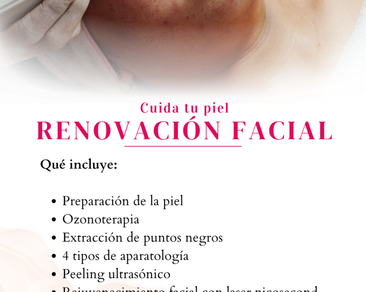 RENOVACIÓN FACIAL
