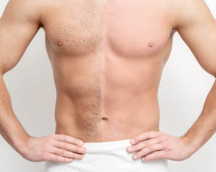 Depilacion Definitiva Cuerpo Completo Hombre + rostro