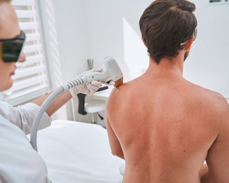 Depilacion Definitiva Cuerpo Completo Hombre + rostro