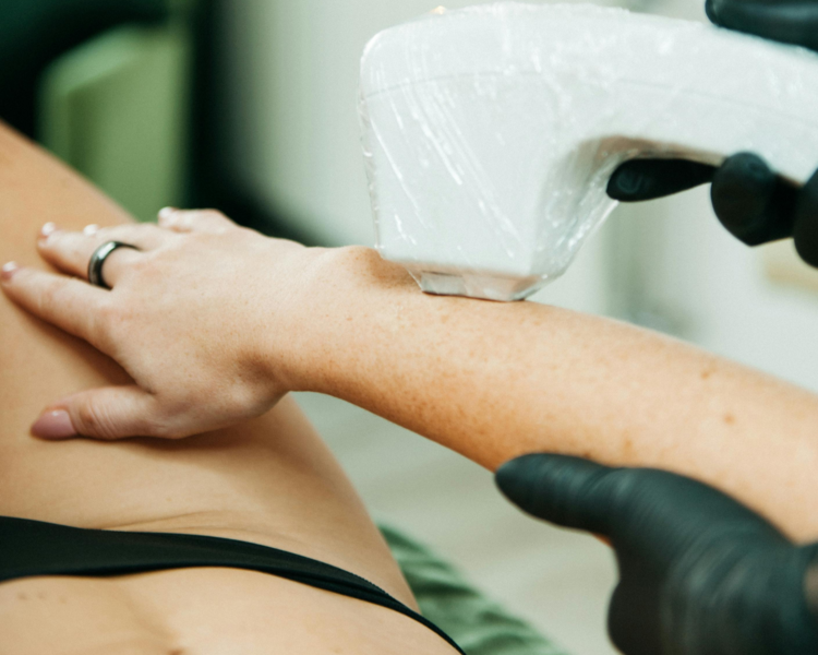 Depilacion Definitiva Cuerpo Completo Mujer + rostro