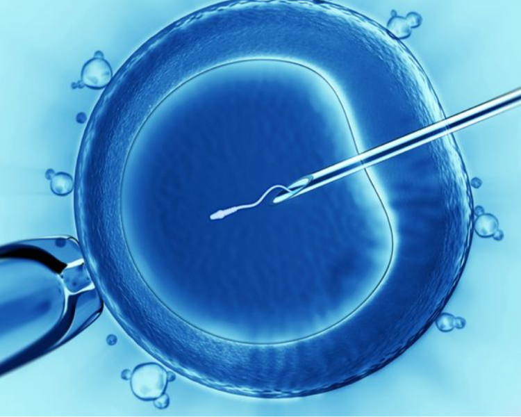 Inseminación Intrauterina