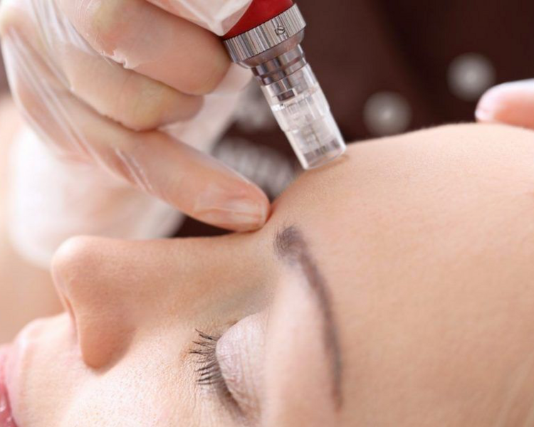 Botox cosmetologico