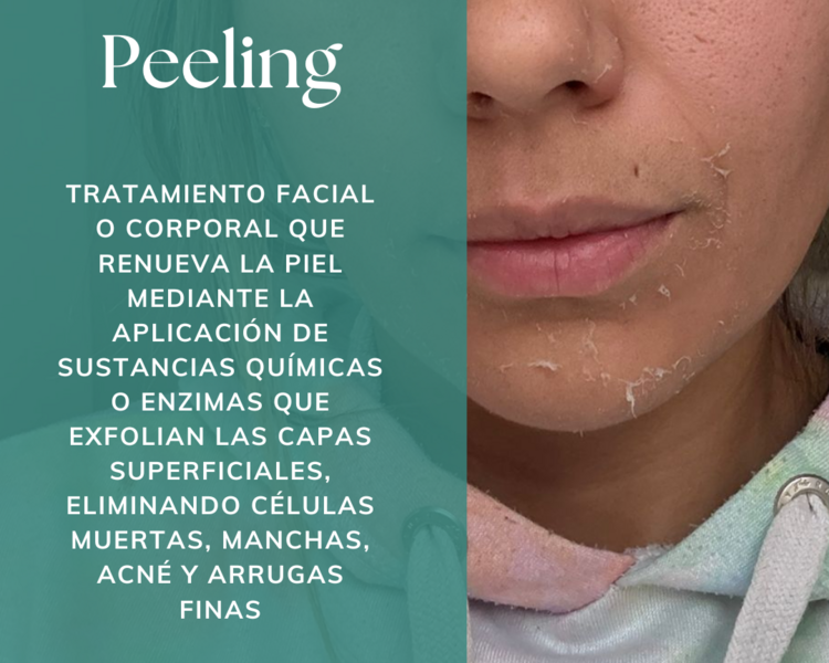 Peeling Suave