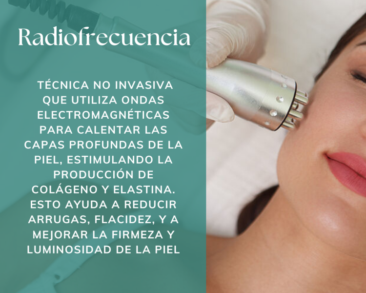 Radiofrecuencia Convencional