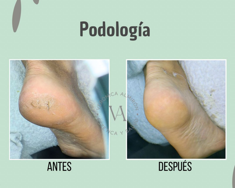 Podología 