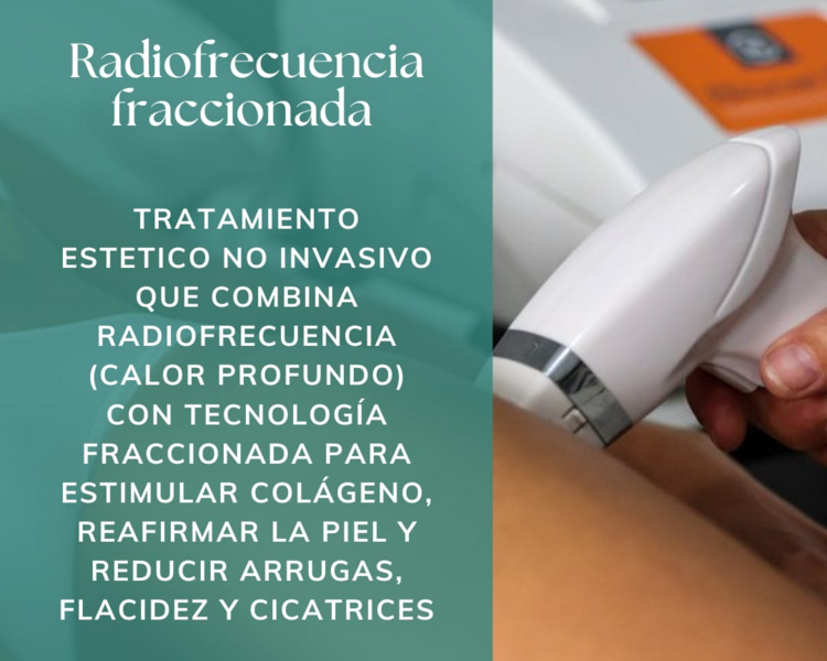 Radio Fraccionada Pantalón de Montar