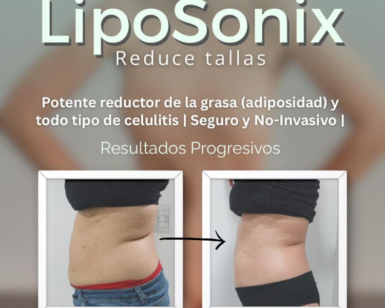 LipoSonix Flancos