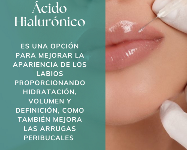 Ácido Hialurónico (Relleno y Perfilado de Labios)