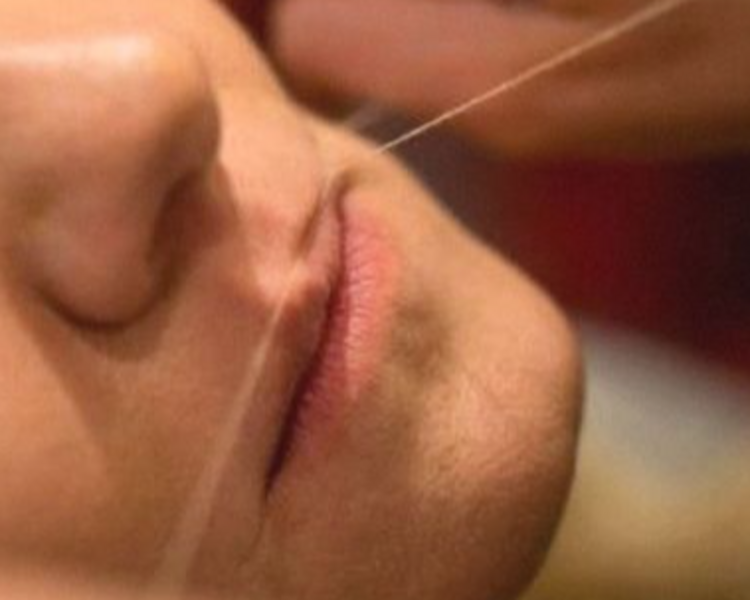 Epilación de Labio Superior