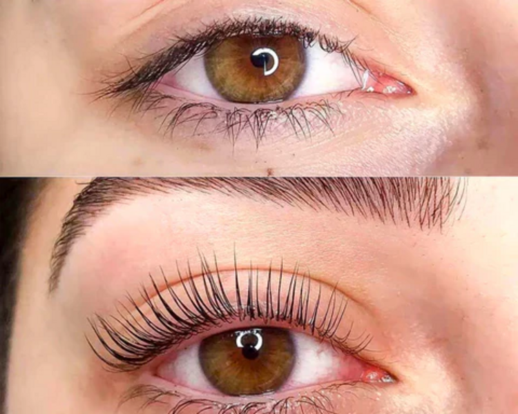 Liffting  + Tinte + Botox + Keratina