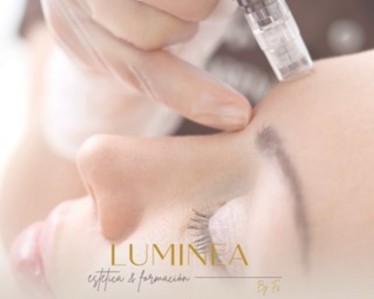 Microneedling