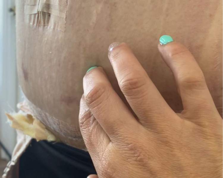 Rehabilitación Dermatofuncional (1 hora)